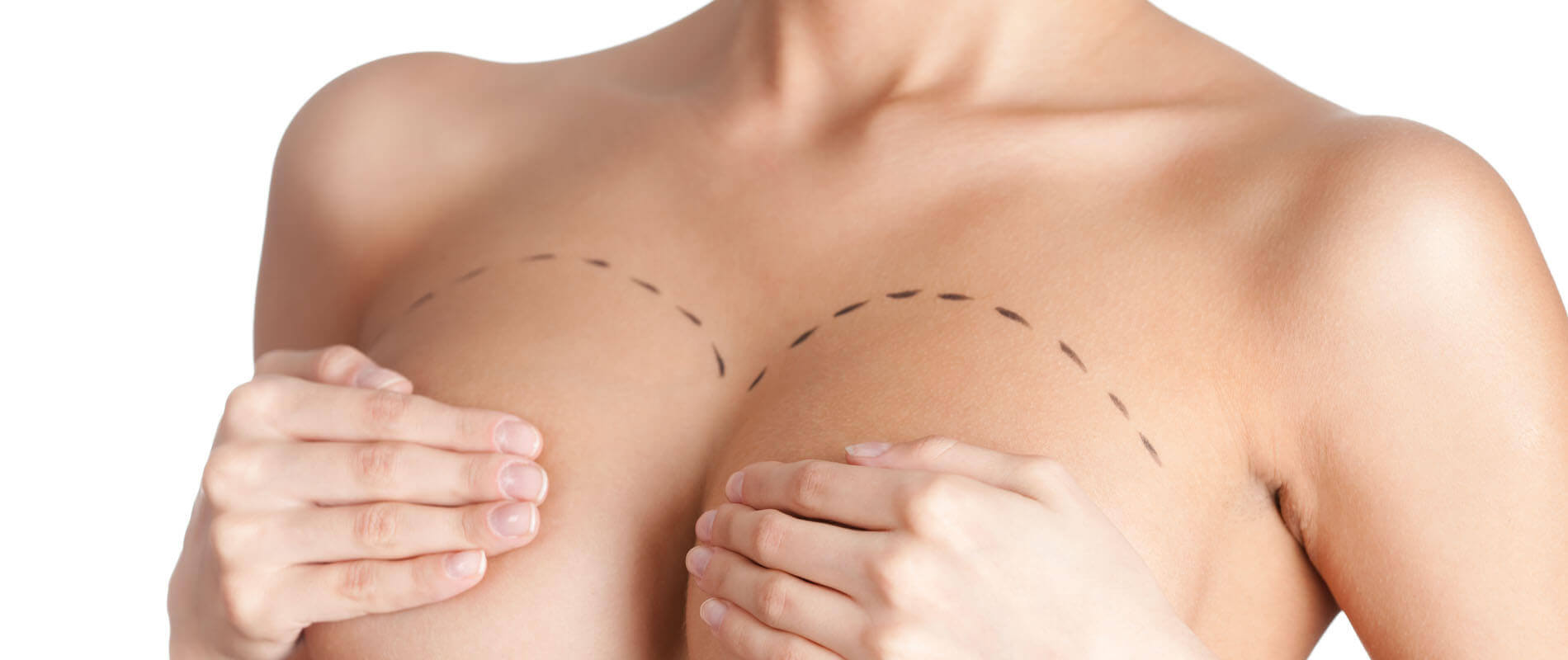 Breast Surgery Clinic in Hyderabad