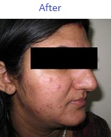 Nose Surgery Hospital